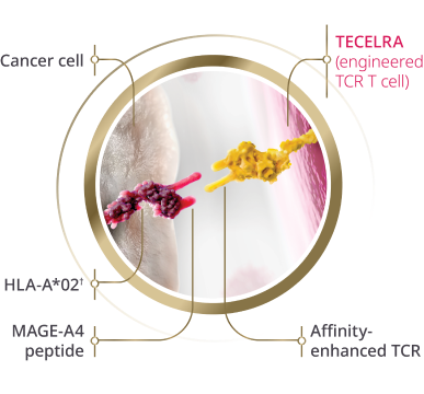 Image of an enhanced TCR on a TECELRA engineered T cell close to an HLA-A*02-presented MAGE-A4 peptide on a cancer cell